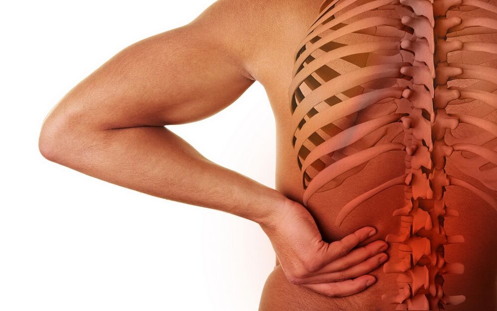 Dolor de espalda debido a la osteocondrosis.