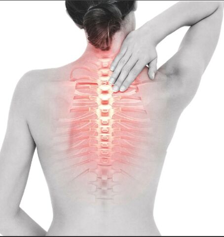 Osteocondrosis de la brustración