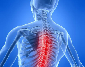 Osteocondrosis de la columna vertebral